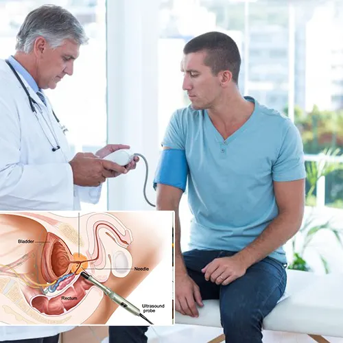 Understanding Penile Implants and Relationship Dynamics