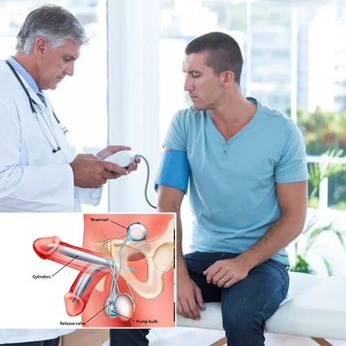 Understanding User-Friendly Penile Implants